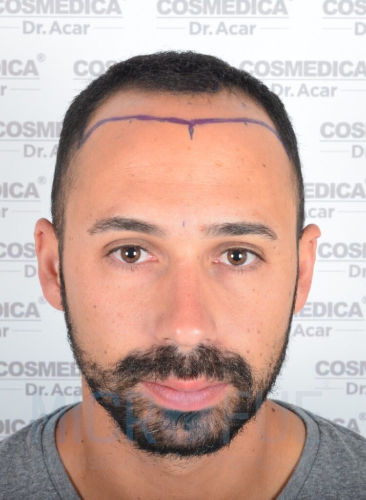 Christian Milano Perez