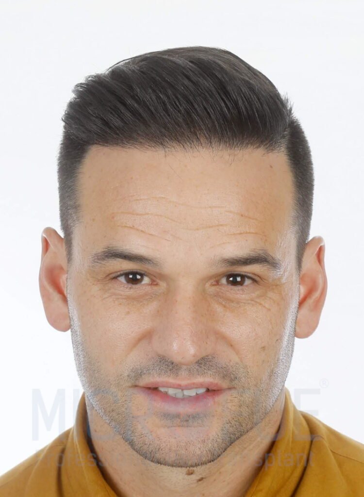 Raul Huertas despues frontal