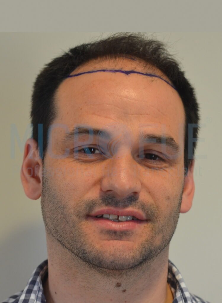 Raul Huertas antes frontal